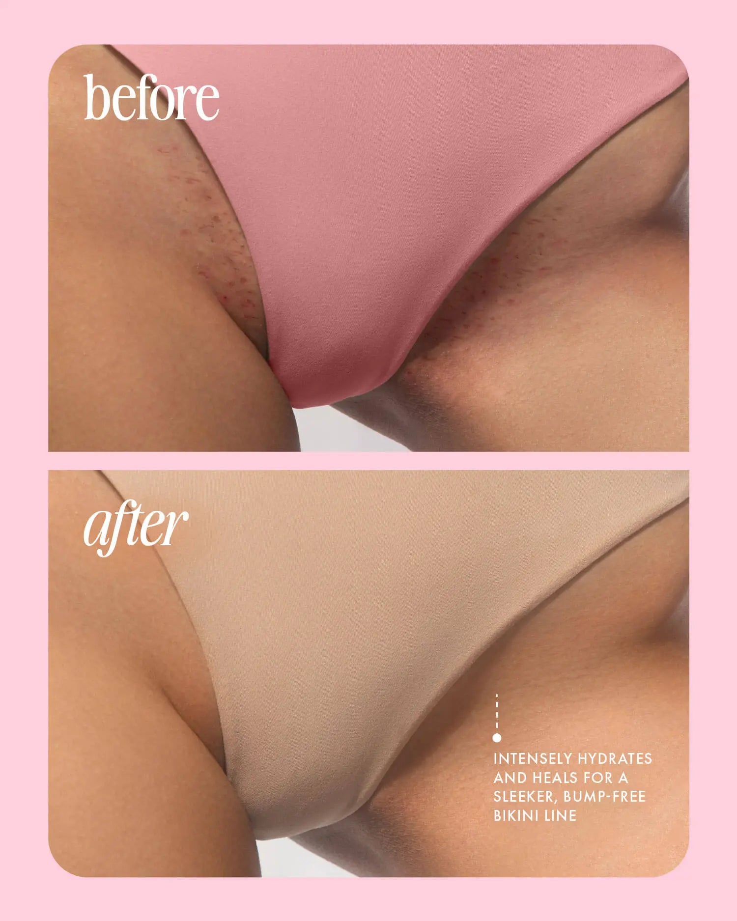Serum removedor de bellos, manchas y mal olor TRULY DermaFade™